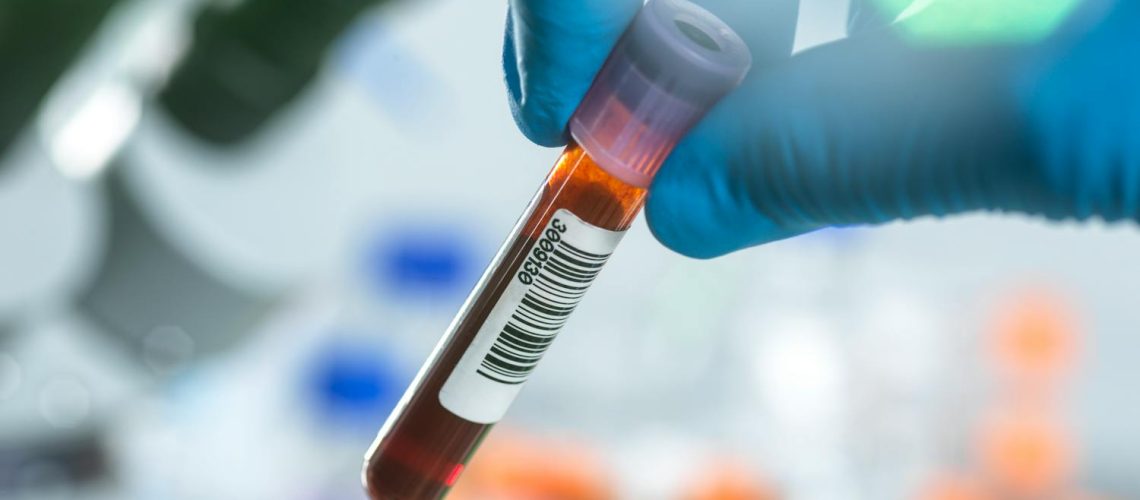 Pourquoi votre médecin prescrit une analyse des plaquettes ?