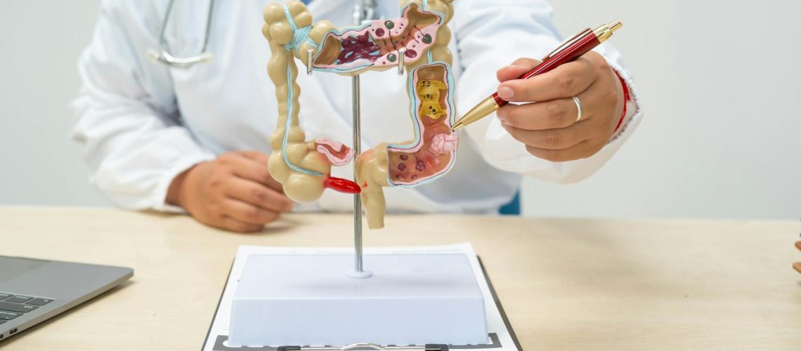 Quels sont les symptômes du cancer du côlon ?